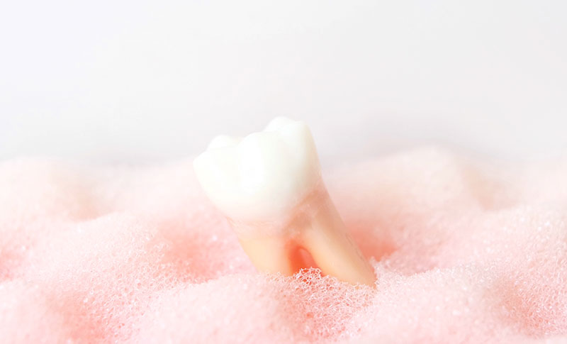 歯並びの乱れによる悪影響